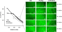 In Vitro Functional and Structural Characterization of A Synthetic Clinical Pulmonary Surfactant with Enhanced Resistance to Inhibition