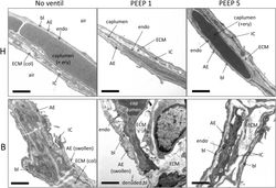 Mechanical ventilation-induced alterations of intracellular surfactant pool and blood-gas barrier in healthy and pre-injured lungs