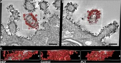 The unremarkable alveolar epithelial glycocalyx: a thorium dioxide-based electron microscopic comparison after heparinase or pneumolysin treatment