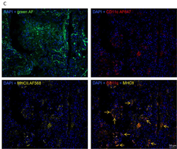 The FMS-like tyrosine kinase-3 ligand/lung dendritic cell axis contributes to regulation of pulmonary fibrosis