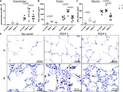 Hidden Microatelectases Increase Vulnerability to Ventilation-Induced Lung Injury