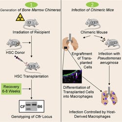 Rescue from Pseudomonas aeruginosa Airway Infection via Stem Cell Transplantation