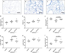 Surfactant dysfunction and alveolar collapse are linked with fibrotic septal wall remodeling in the TGF-β1-induced mouse model of pulmonary fibrosis