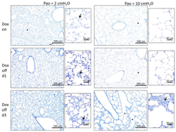 Surfactant Protein B Deficiency Induced High Surface Tension: Relationship between Alveolar Micromechanics, Alveolar Fluid Properties and Alveolar Epithelial Cell Injury