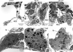 Linking progression of fibrotic lung remodeling and ultrastructural alterations of alveolar epithelial type II cells in the amiodarone mouse model