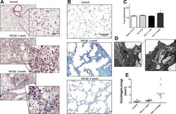 Surfactant dysfunction during overexpression of TGF-β1 precedes profibrotic lung remodeling in vivo