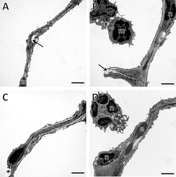 Aging exacerbates acute lung injury-induced changes of the air-blood barrier, lung function, and inflammation in the mouse