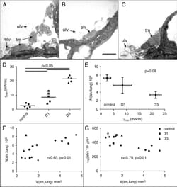 Alveolar derecruitment and collapse induration as crucial mechanisms in lung injury and fibrosis