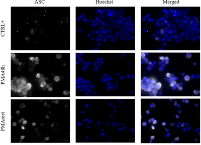 Resting time after phorbol 12-myristate 13-acetate in THP-1 derived macrophages provides a non-biased model for the study of NLRP3 inflammasome