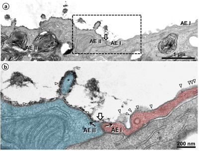 On Top of the Alveolar Epithelium: Surfactant and the Glycocalyx