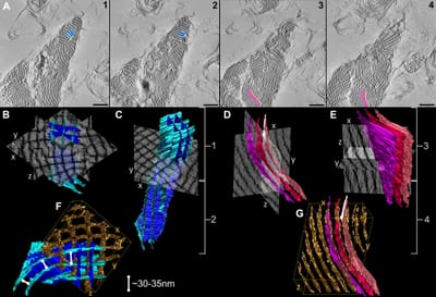 The ultrastructural heterogeneity of lung surfactant revealed by serial section electron tomography: insights into the 3-D architecture of human tubular myelin