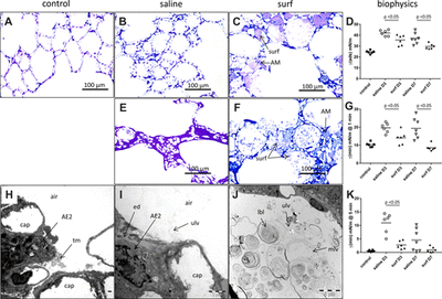 Surfactant replacement therapy reduces acute lung injury and collapse induration-related lung remodeling in the bleomycin model