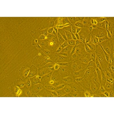 Characterization of commercially available human primary alveolar epithelial cells