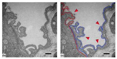 Comparative electron microscopic visualization of the lung alveolar epithelial glycocalyx with different staining and labeling methods