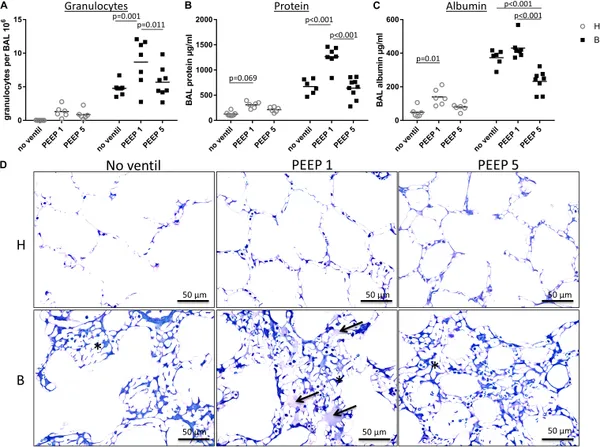 Hidden Microatelectases Increase Vulnerability to Ventilation-Induced Lung Injury