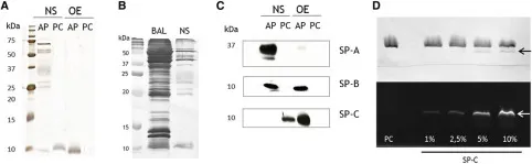 Protein and lipid fingerprinting of native-like membrane complexes by combining TLC and protein electrophoresis