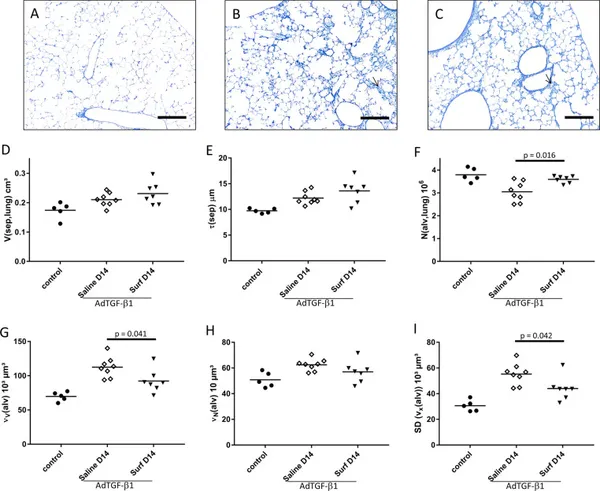 Surfactant dysfunction and alveolar collapse are linked with fibrotic septal wall remodeling in the TGF-β1-induced mouse model of pulmonary fibrosis