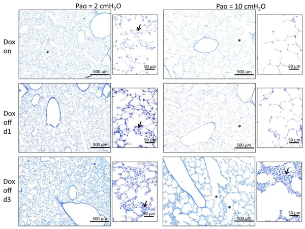 Surfactant Protein B Deficiency Induced High Surface Tension: Relationship between Alveolar Micromechanics, Alveolar Fluid Properties and Alveolar Epithelial Cell Injury