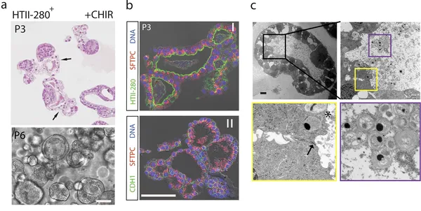 Human alveolar progenitors generate dual lineage bronchioalveolar organoids