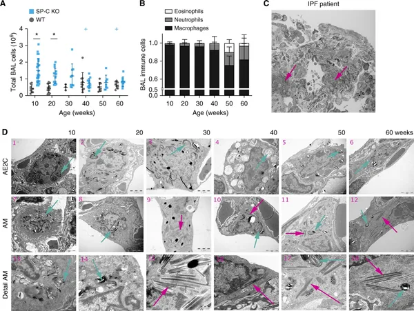 Air Space Distension Precedes Spontaneous Fibrotic Remodeling and Impaired Cholesterol Metabolism in the Absence of Surfactant Protein C